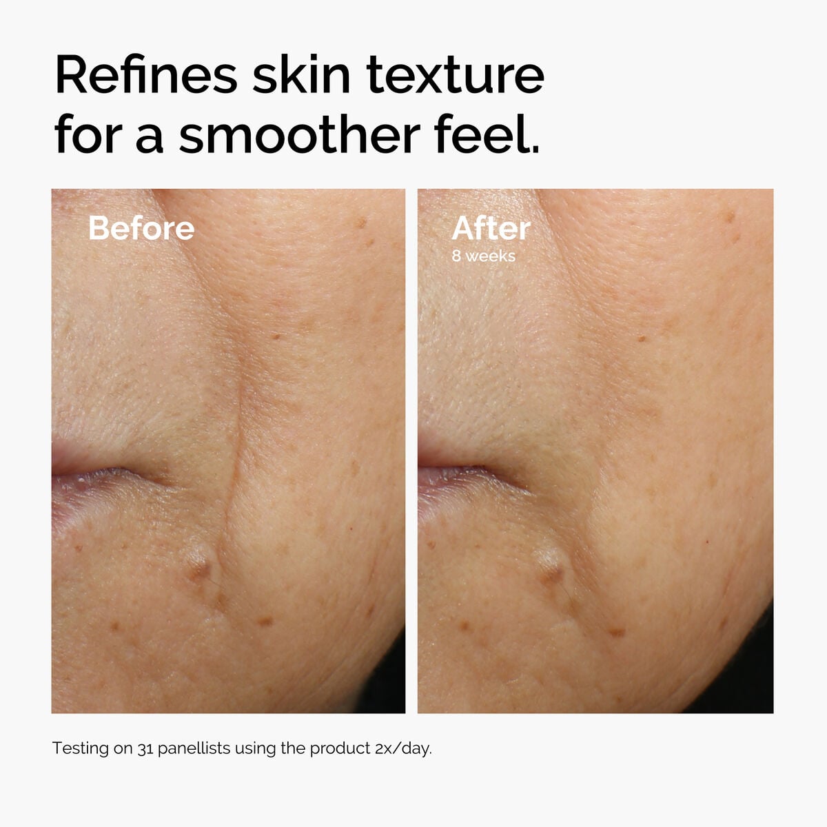 Caffeine + Escin Face Serum Targeted Serum Care R2