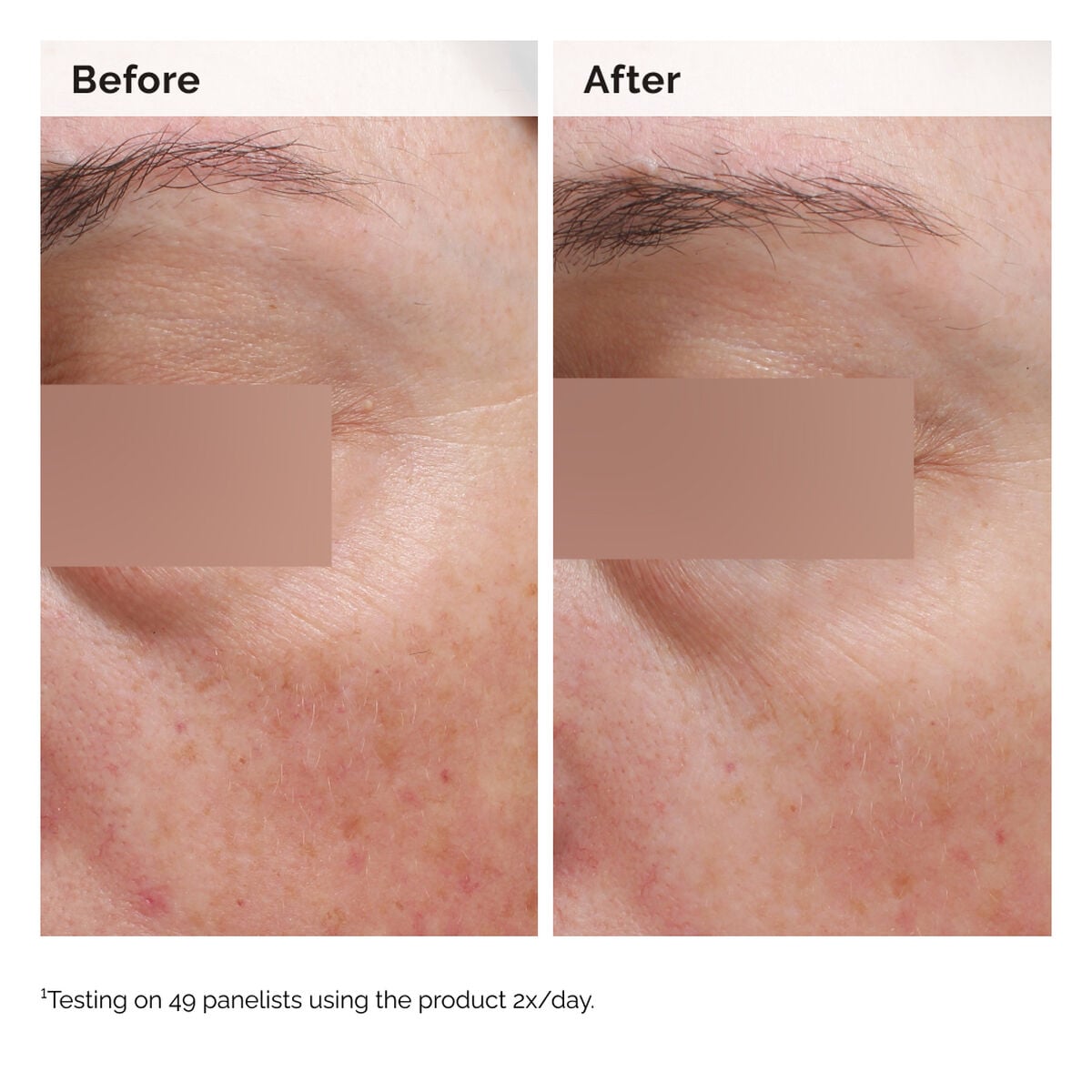 Niacinamide Face and Body Emulsion Targeted Serum Care K0