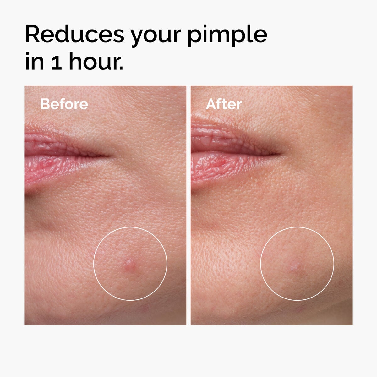 Sulfur Powder-to-Cream Concentrate Targeted Serum Care Y1